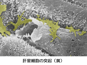 肝星細胞の突起