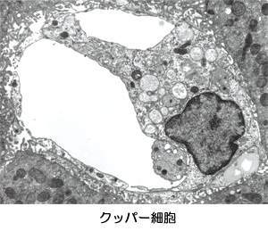 クッパー細胞
